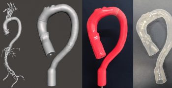 Dall'immagine diagnostica al modello in silicone